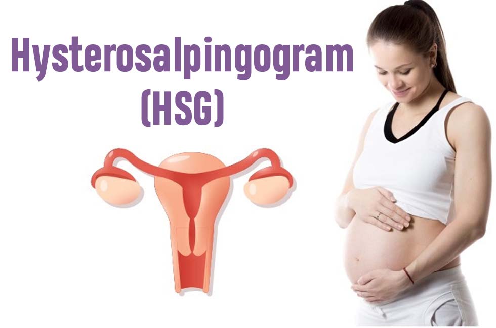 HSG (Hystero-salpingogram)