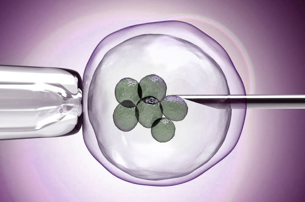 In vitro Fertilization (IVF)