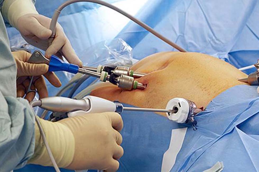 Laparoscopy Hysteroscopy Infertility Services